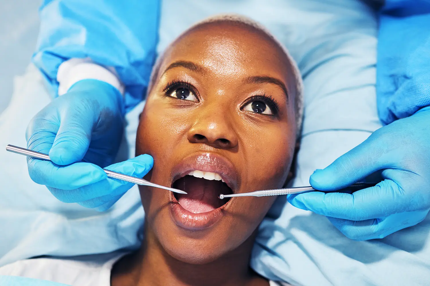 Dentist using surgical pliers to remove a decaying tooth