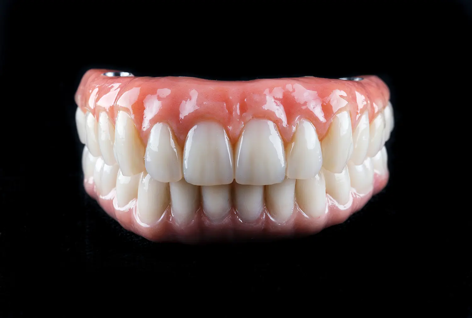 conover full arch dental implants